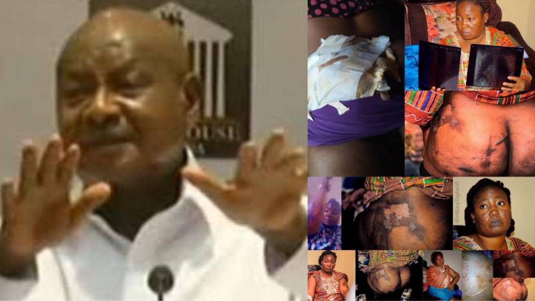 Museveni’s hit squad kills opposition supporter after torturing, gang-raping, and infecting her with HIV